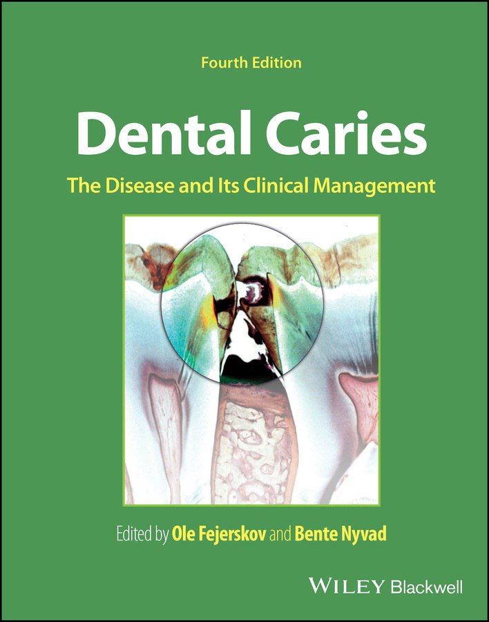 Dental Caries: The Disease and its Clinical Management, 4th Edition
