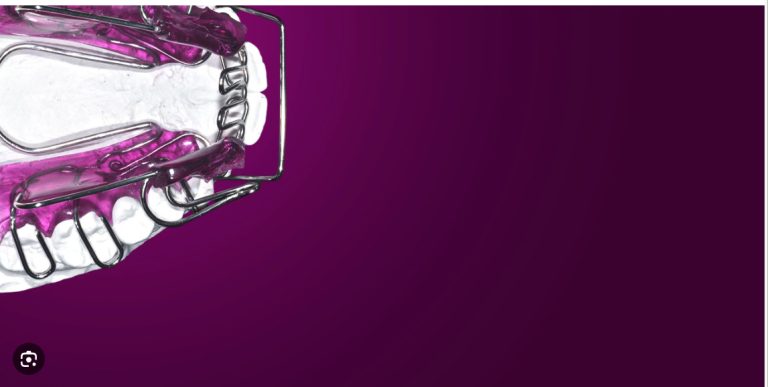 Functional orthodontic treatment. Bimler`s appliance by Barbara Bimler cover