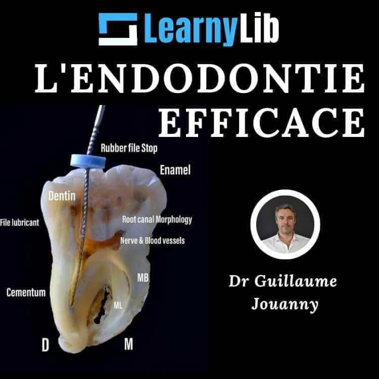 LearnyLib L’Endodontie Efficace – Guillaume Jouanny (Francais)