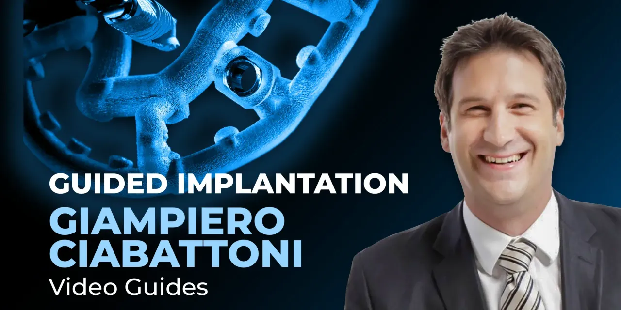 Navigation implant surgery video guides