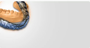 OCTA concept: Occlusal architecture to secure orthodontic or prosthodontic adults treatments