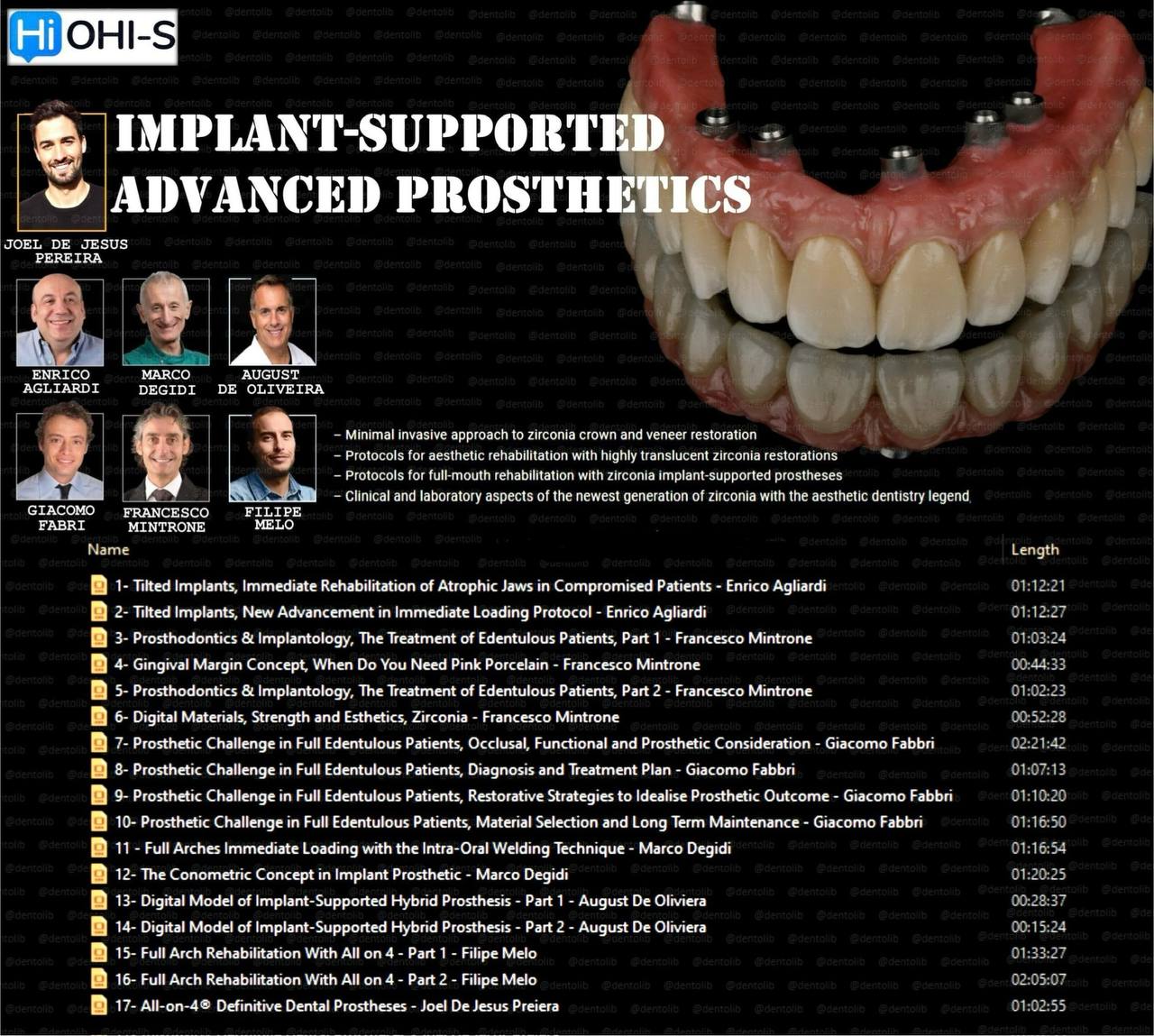 OHI-S Implant-Supported Advanced Prosthesis