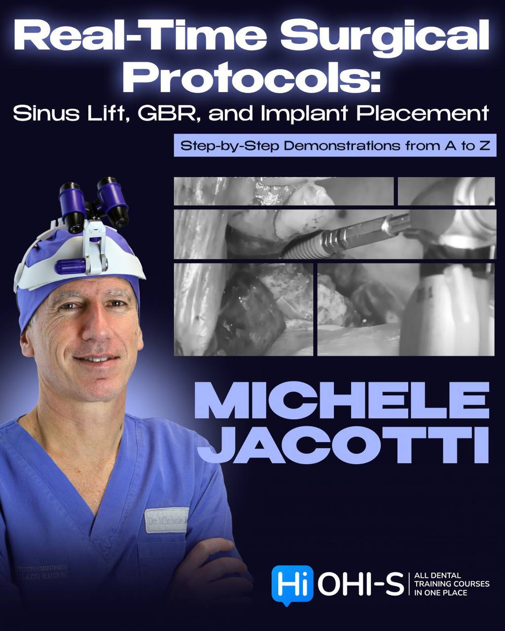 Real-Time Surgical Protocols: Sinus Lift, GBR, and Dental Implant Placement — Step-by-Step Guide from A-to-Z