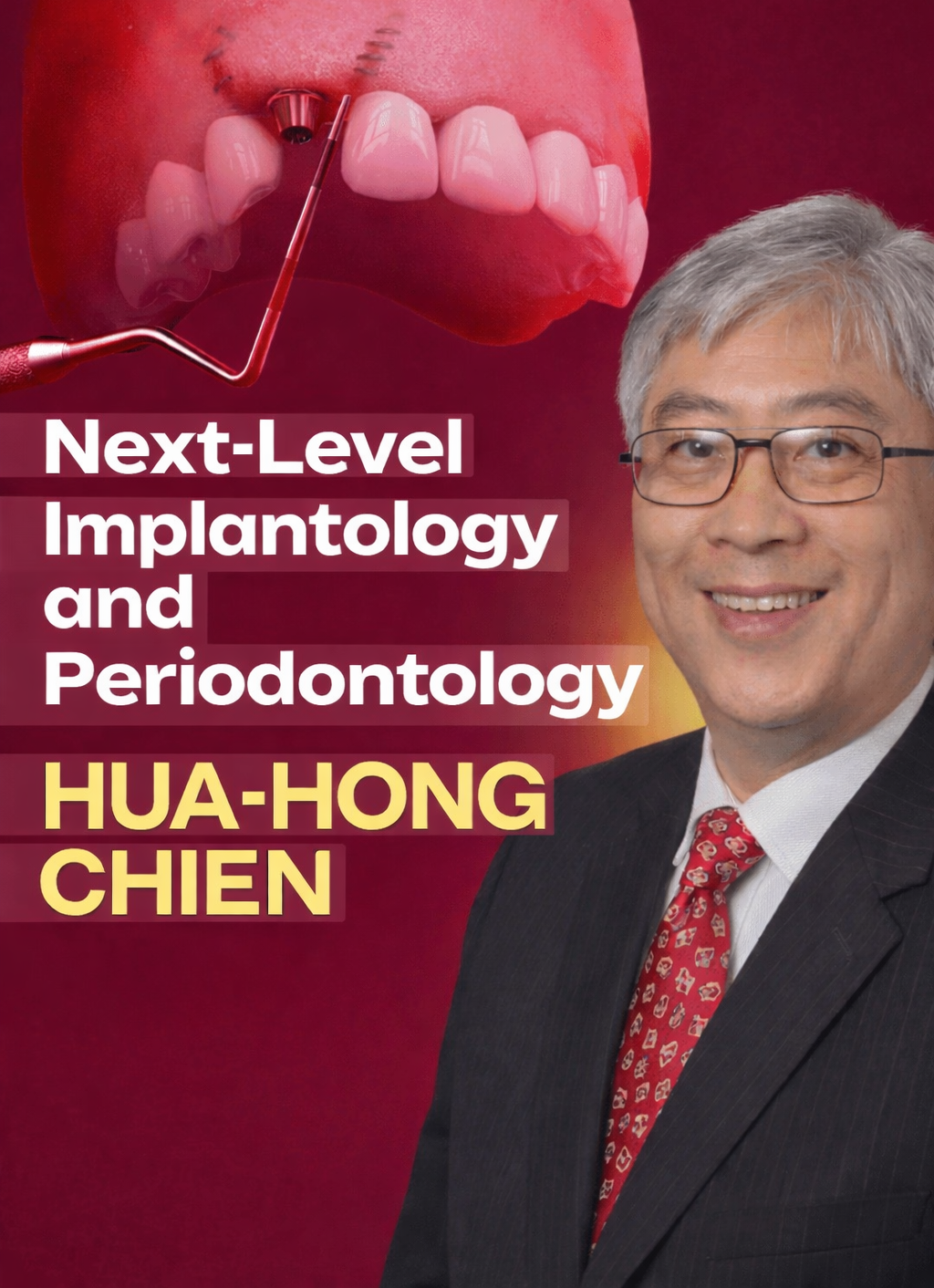 Next-Level Implantology and Periodontology-Mastering Immediate Implantation, Peri-implant Soft Tissue Augmentation, Sinus Lifting