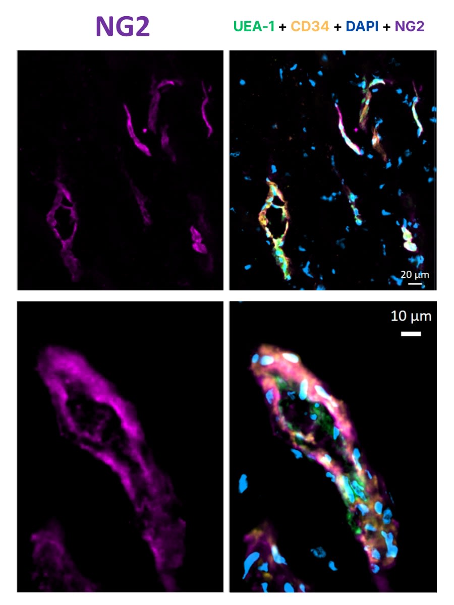 Fluorescent perivascular stem cells