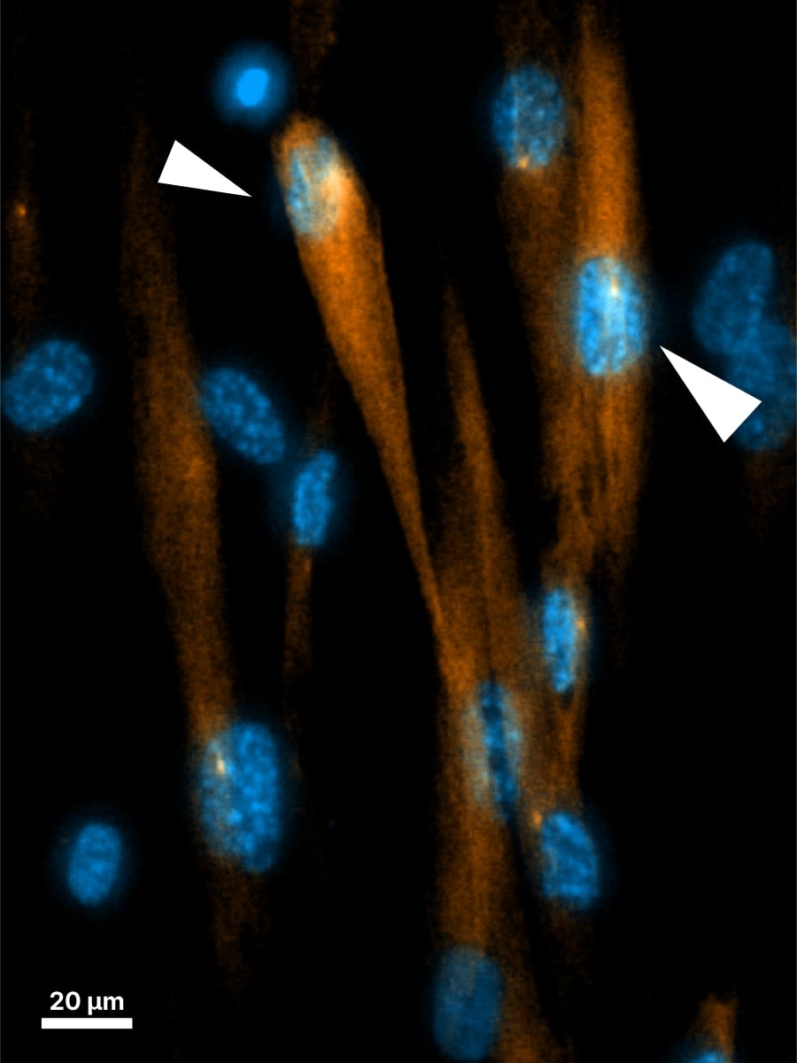 Neurogenesis at day 30