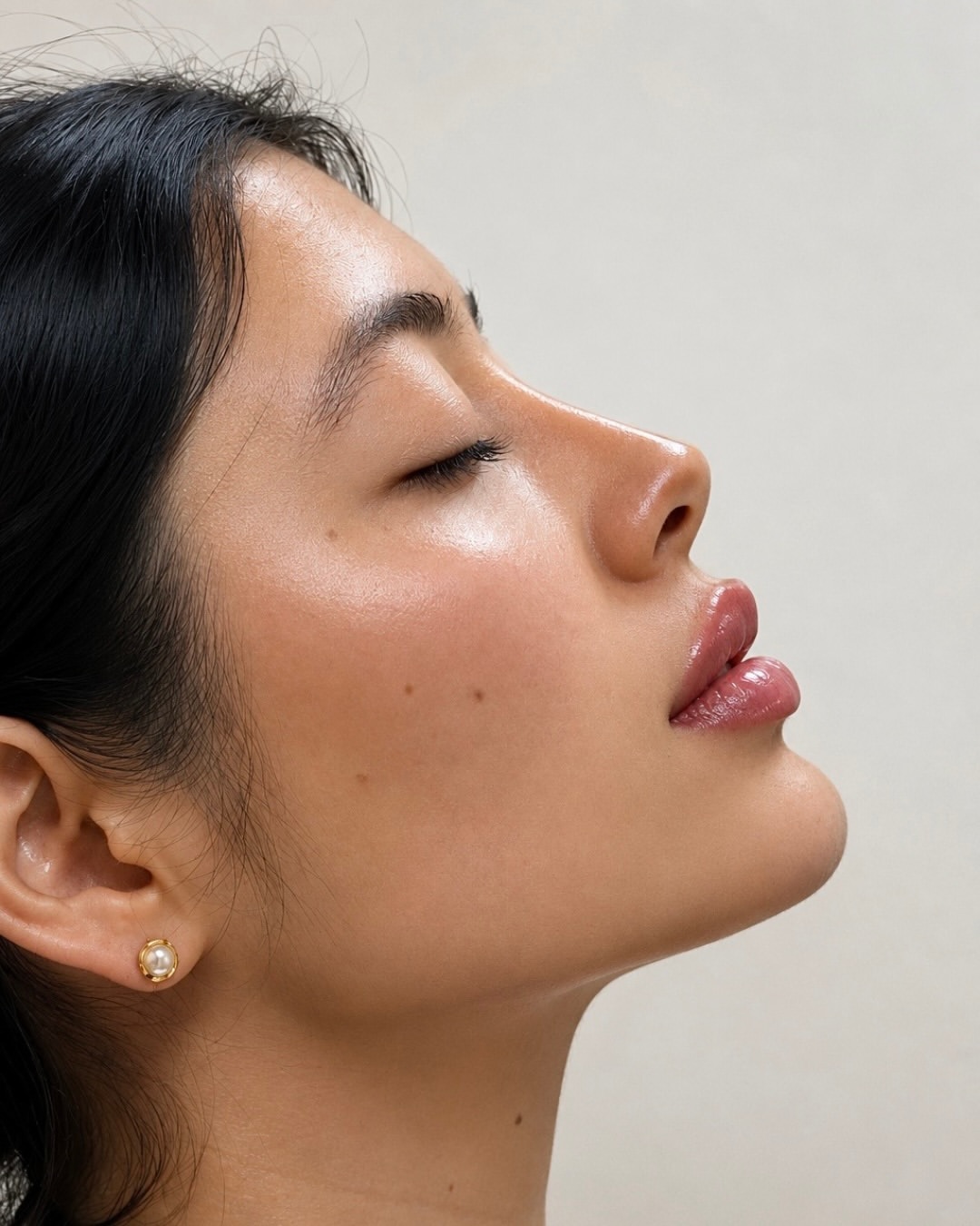 Antes y después · Aumento de labios