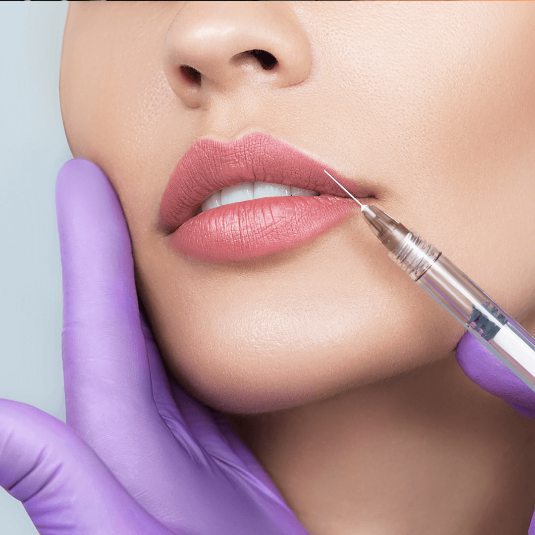 Aumento de labios