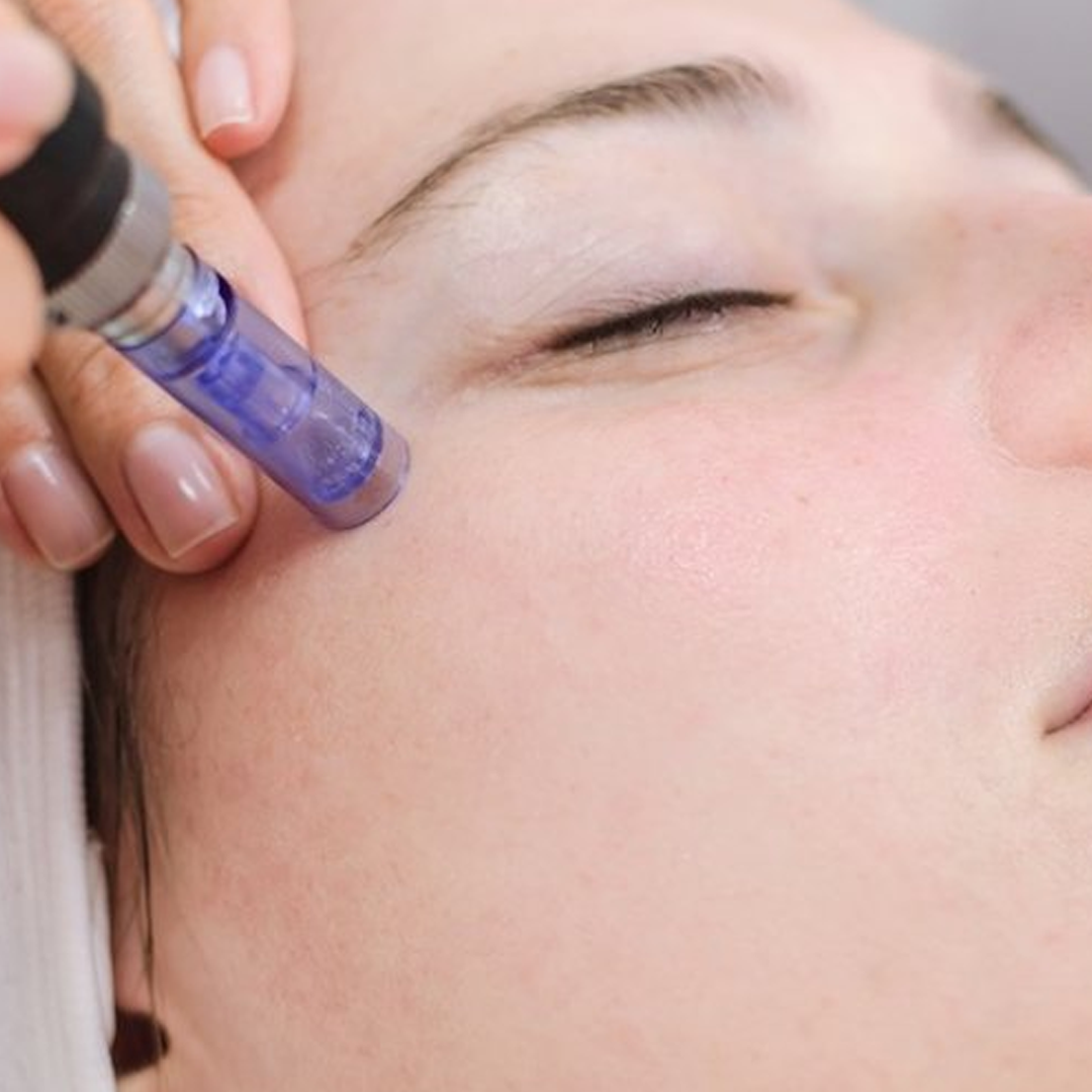 Dermapen