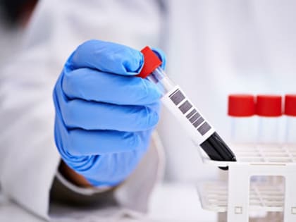 Жителям Самарской области начали звонить с просьбой сдать кровь для военных