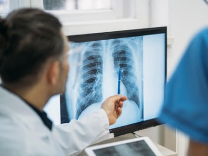 Рак лёгких связан с курением: мнение пульмонолога