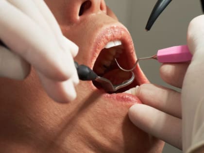 Не закрывайте рот, у вас, похоже, рак: когда надо срочно бежать к врачу