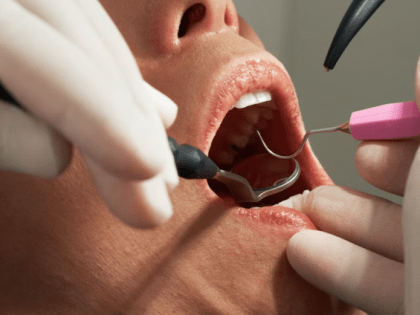 Травма языка и до рака доведет: пять явных признаков страшной болезни