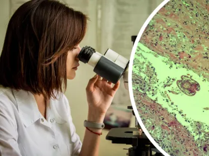 Опухоль мозга, паразит и рак кожи: как выглядят опасные болезни — удивительные снимки, сделанные под микроскопом