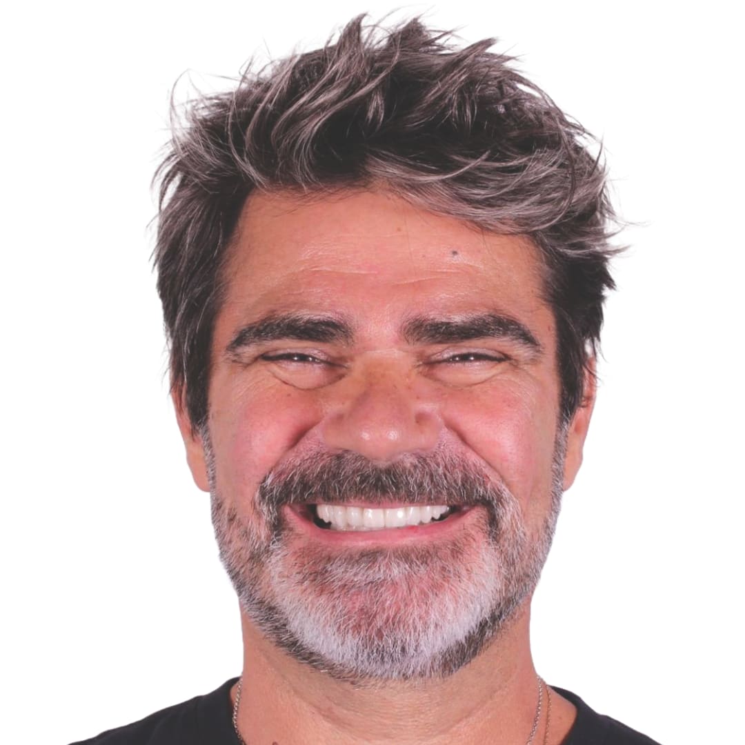Rehabilitación cerámica con carillas — después — rostro frontal — Dr. Ariel Merino AM Estética Dental Buenos Aires