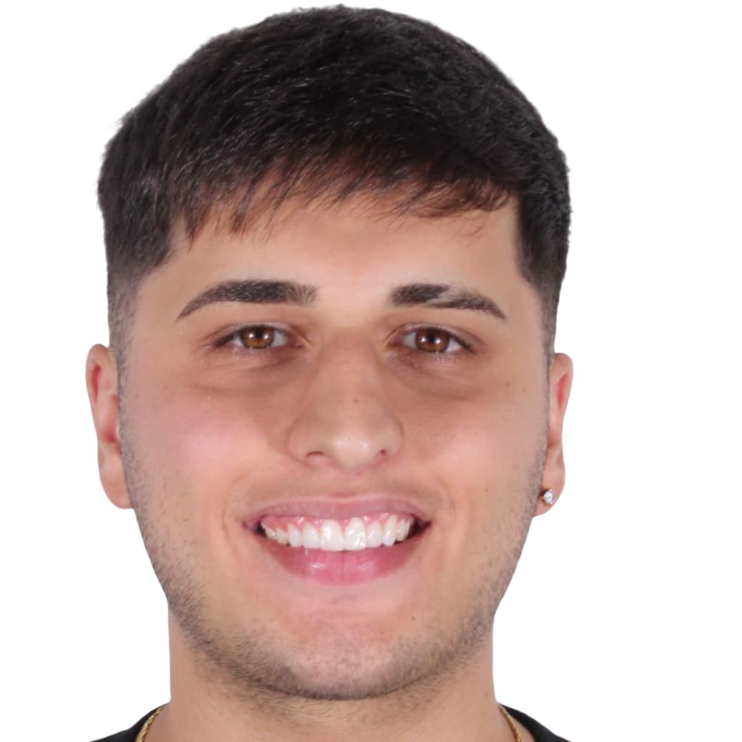 Carillas de resina diseño de sonrisa después — rostro frontal — Dr. Ariel Merino AM Estética Dental Puerto Madero