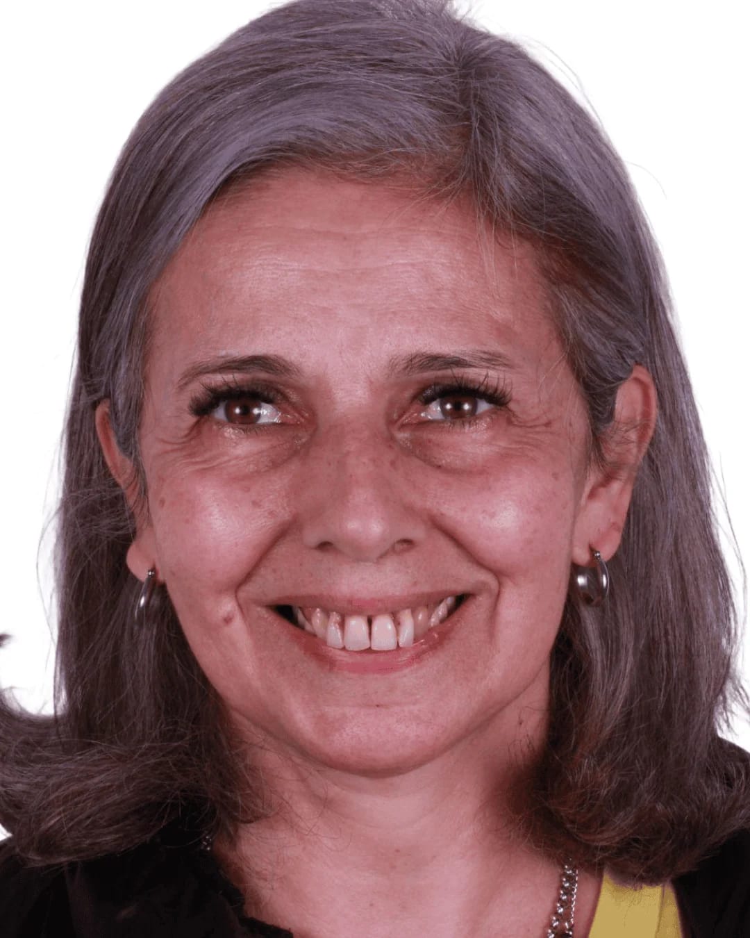 Antes y después diseño de sonrisa con carillas cerámicas — AM Estética Dental Buenos Aires
