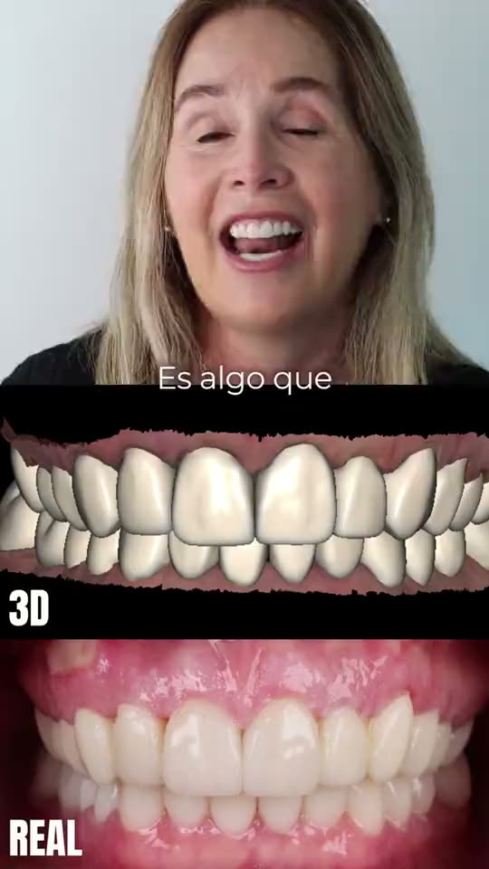 Testimonio en video de un paciente de AM Estética Dental