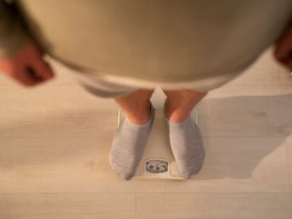 Число югорчан с ожирением выросло в два раза за 10 лет