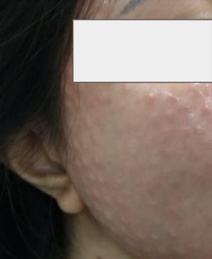 Proper treatment outcome