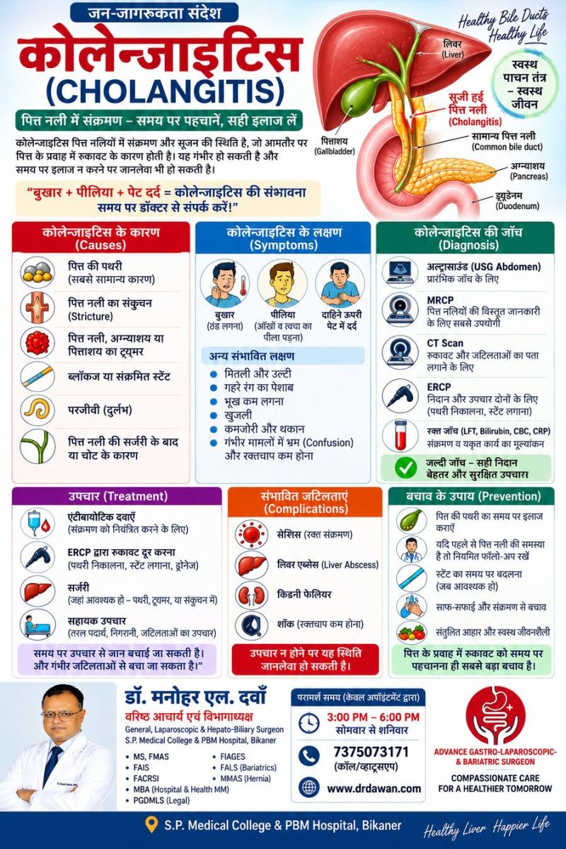 Cholangitis (कोलेन्जाइटिस): पित्त नली में संक्रमण के लक्षण, कारण, जांच और उपचार