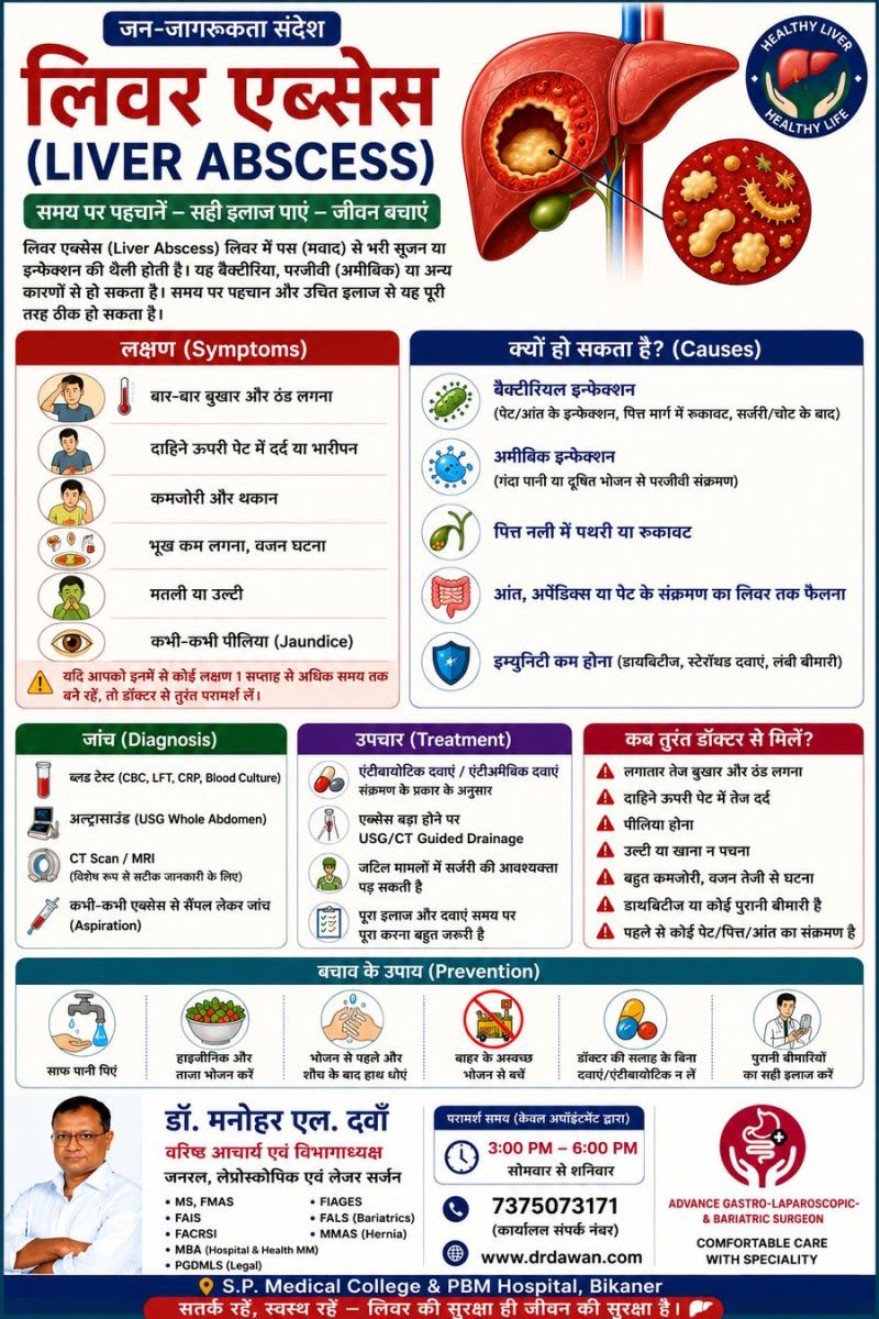 Liver Abscess: Causes, Symptoms, Diagnosis & Treatment | लिवर एब्सेस