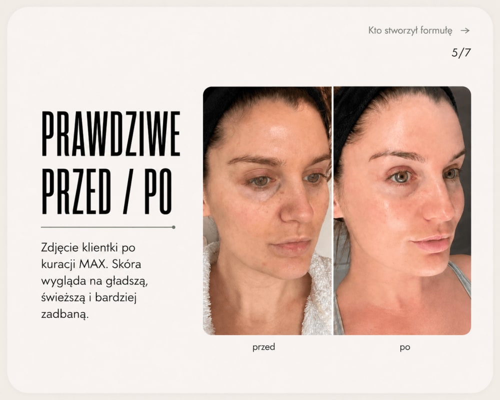 Efekt przed i po — 3 tygodnie