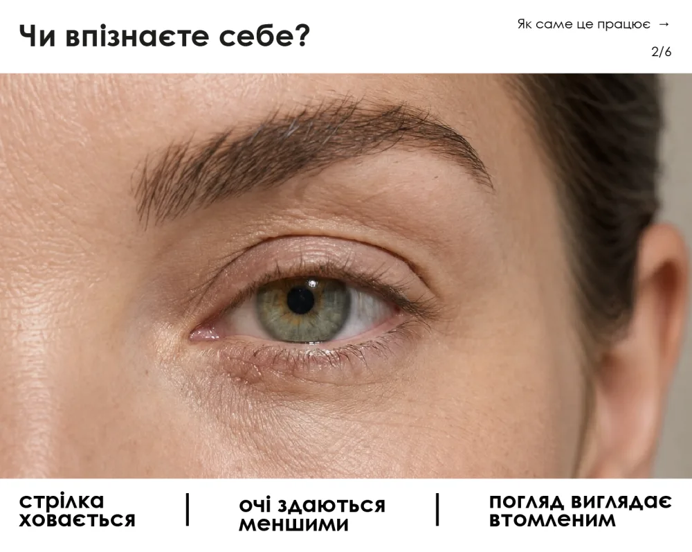 BEAUTIFEYE® — ранні ознаки