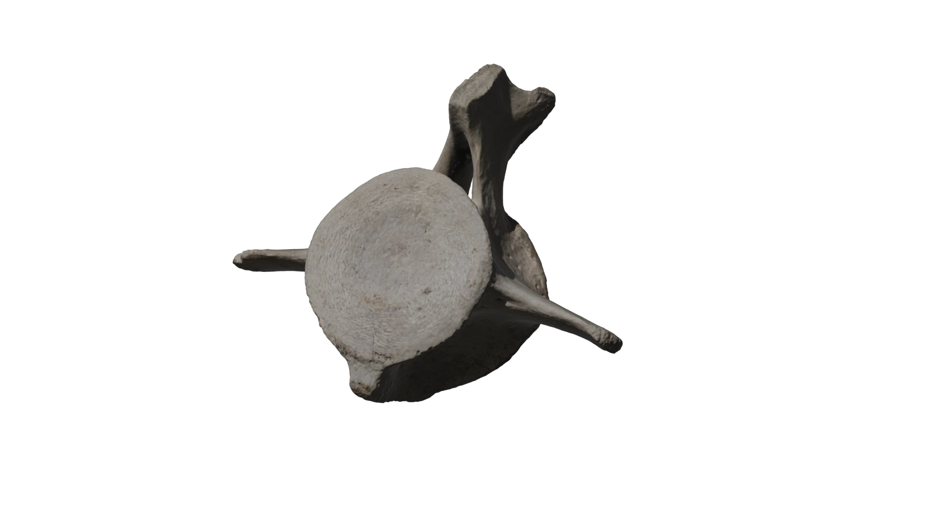Whale Bone Scan