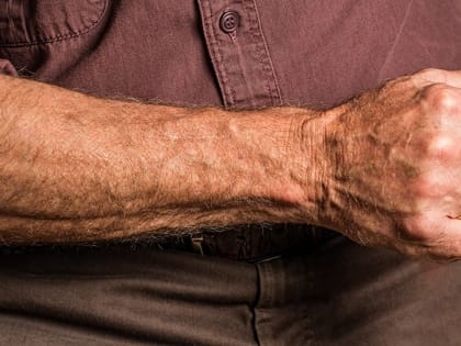 В Саратове задержан мужчина за причинение вреда здоровью