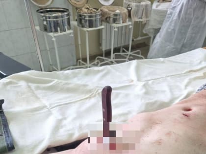 В Марксе прооперировали мужчину с ножом в груди