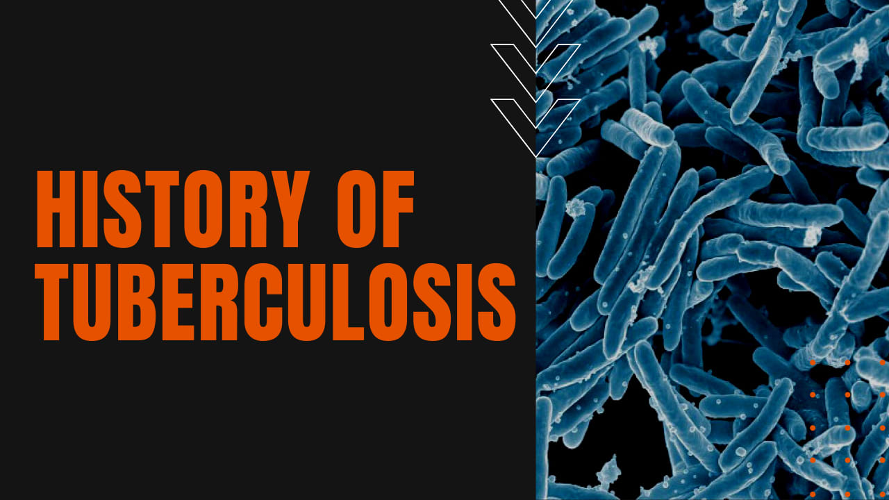History Of Tuberculosis The Daily Dose 