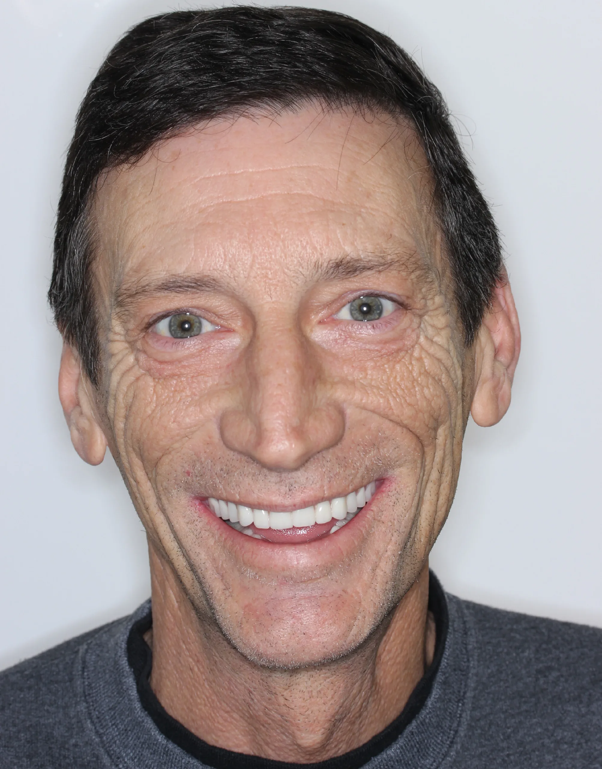 Jeffrey-Hazelbaker After All-on-4®
