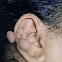 EAR