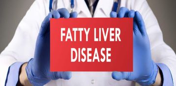 FATTY LIVER