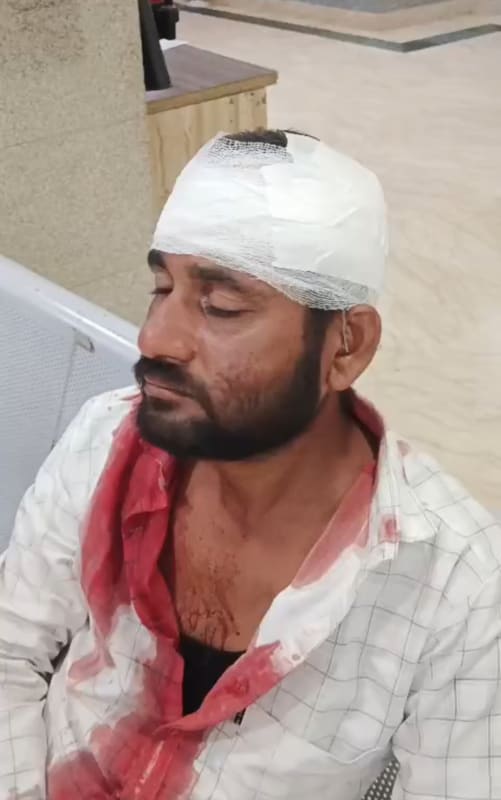 एम्स के गेट पर मामूली तकरार ने लिया खौफनाक मोड़, इमाम खान पर हमला—दो हमलावर फरार