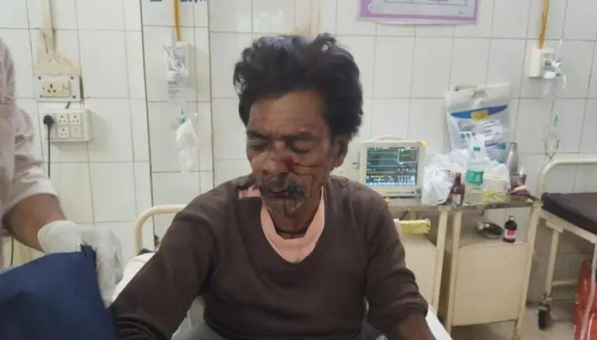 सेसई में प्रिंटिंग प्रेस की मशीन लेकर जा रहे मजदूरों को अज्ञात वाहन ने मारी टक्कर, 4 घायल; 2 मेडिकल कॉलेज रेफर