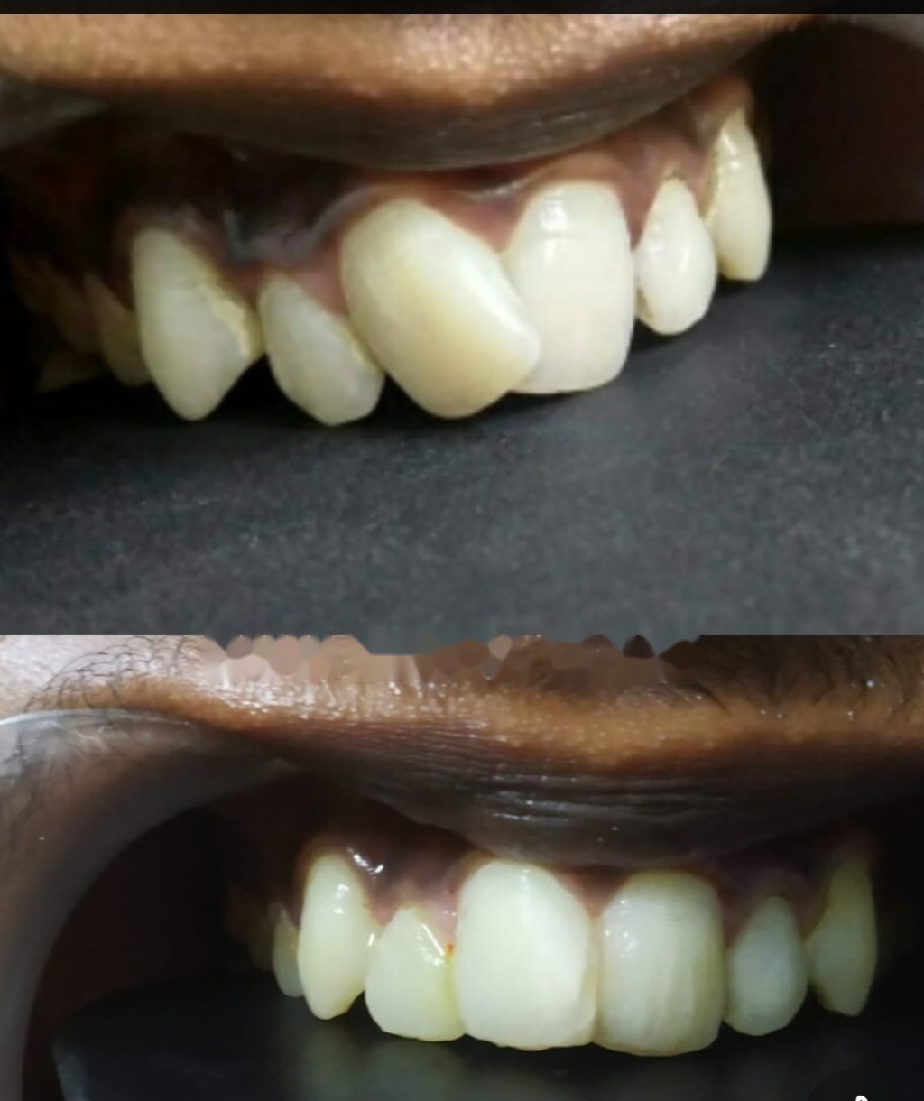 Before and after dental treatment