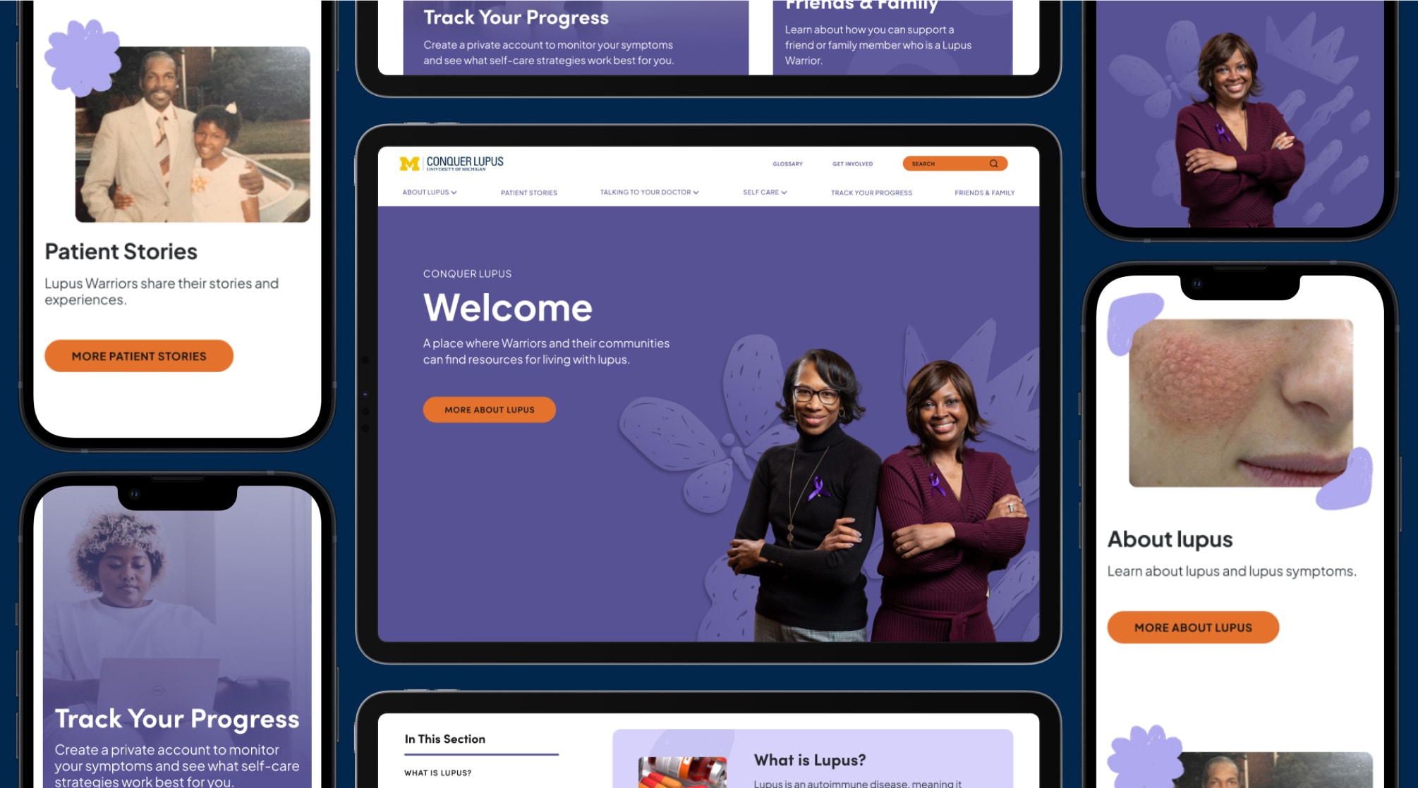 Conquer Lupus website screenshots