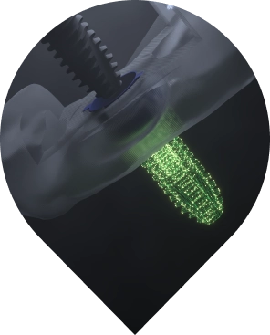 DIO NAVI UV Plus Abutment