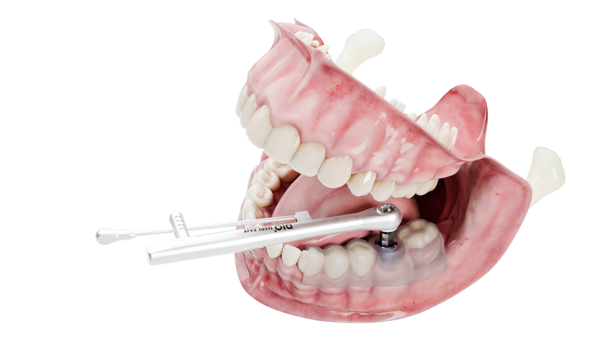 DIO NAVI Initial Drill