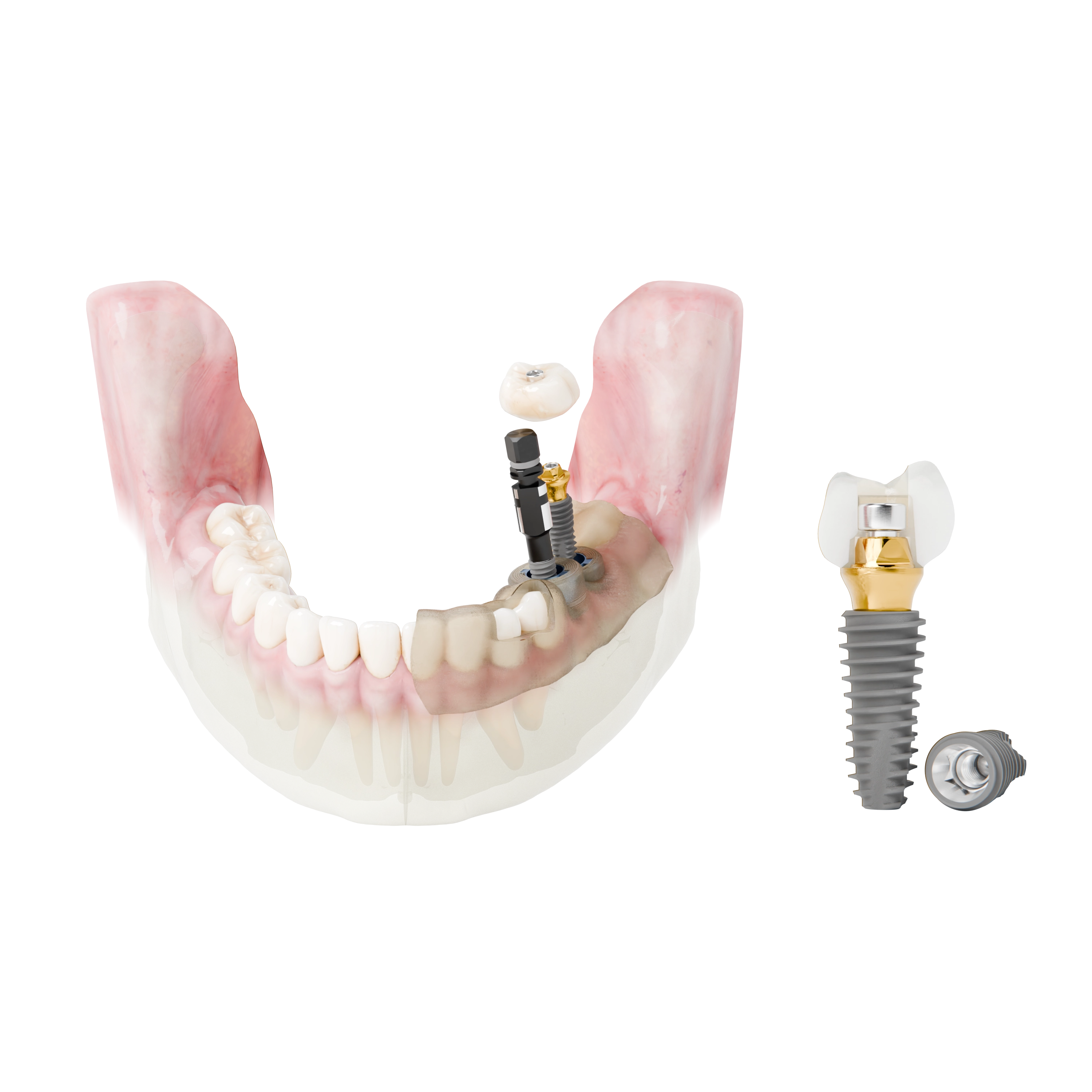 DIO NAVI Yüzey Teknolojisi