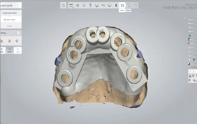 Cerrahi Rehber Üretimi