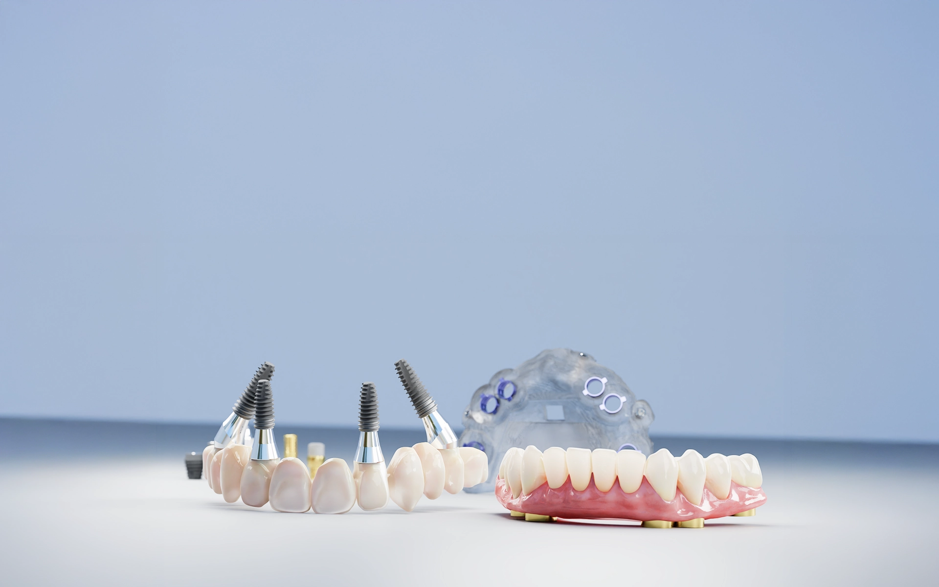 Full Arch sistem bileşenleri — genel görünüm