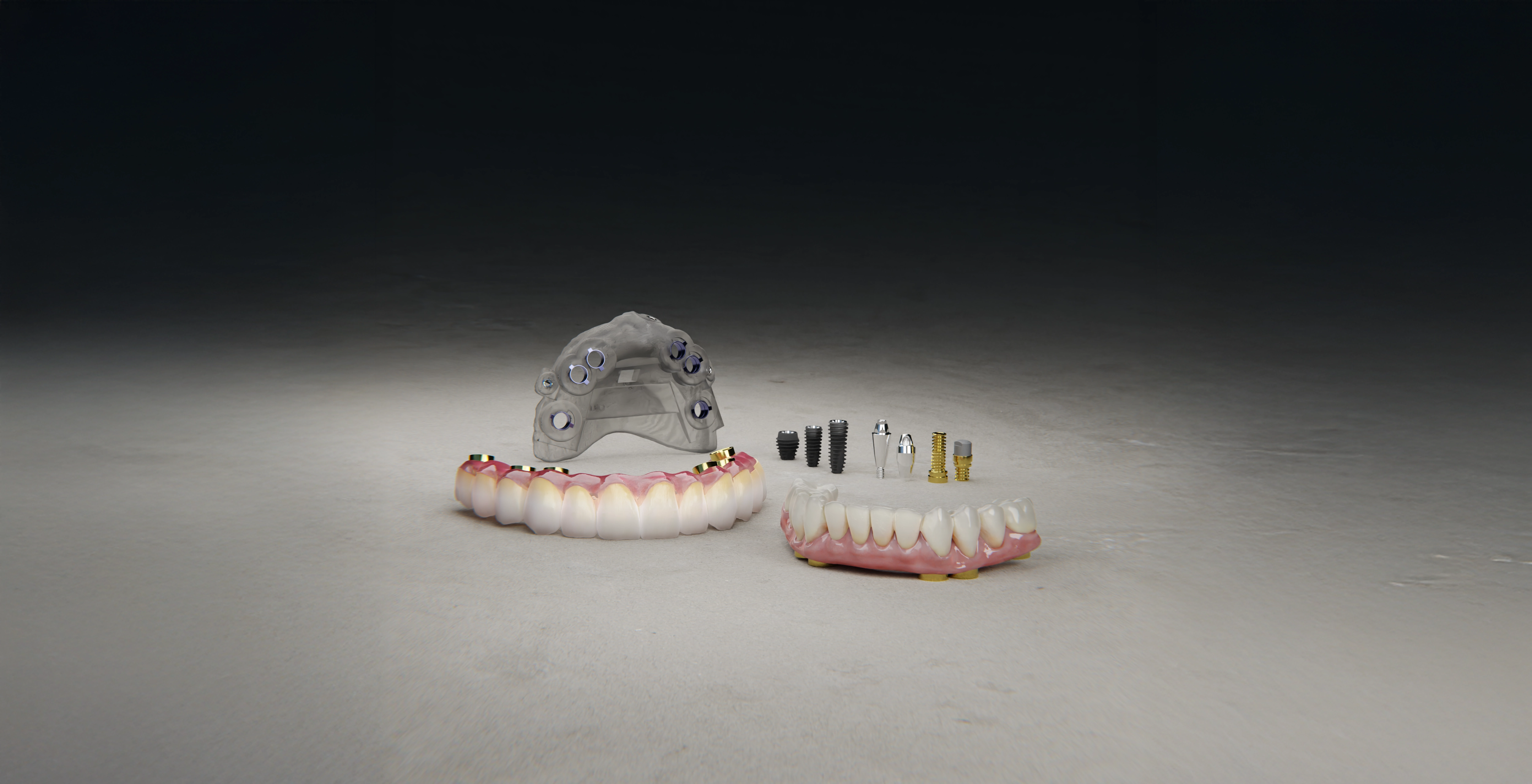 Full Arch sistem bileşenleri — ürün seti ve kılavuz