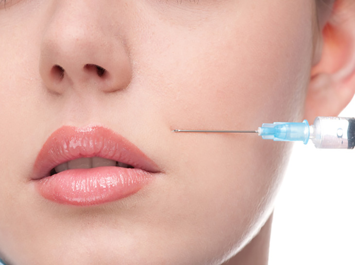 Fillers injections