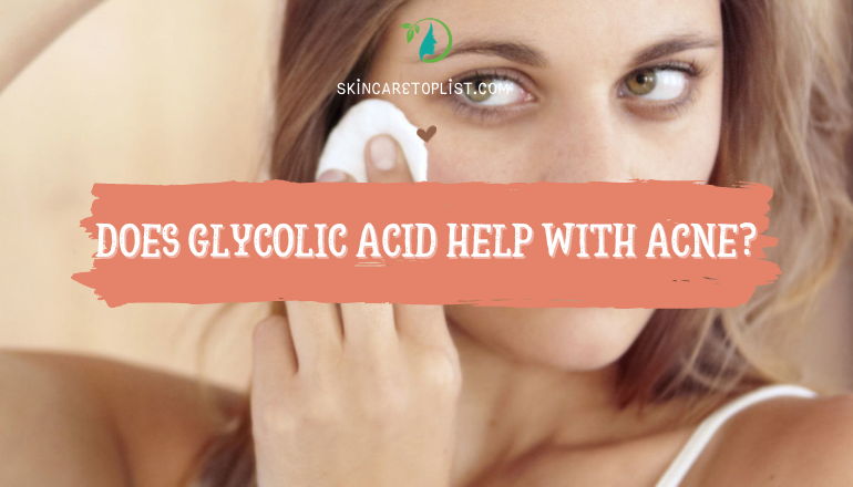 Does Glycolic Acid Help With Acne?