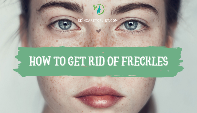 Goodbye Freckles: How To Get Rid Of Freckles On Your Skin?