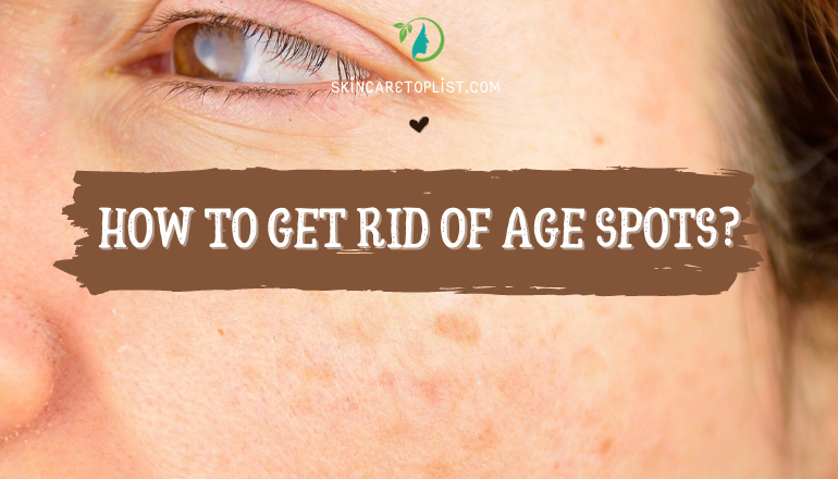 How to Get Rid of Age Spots?