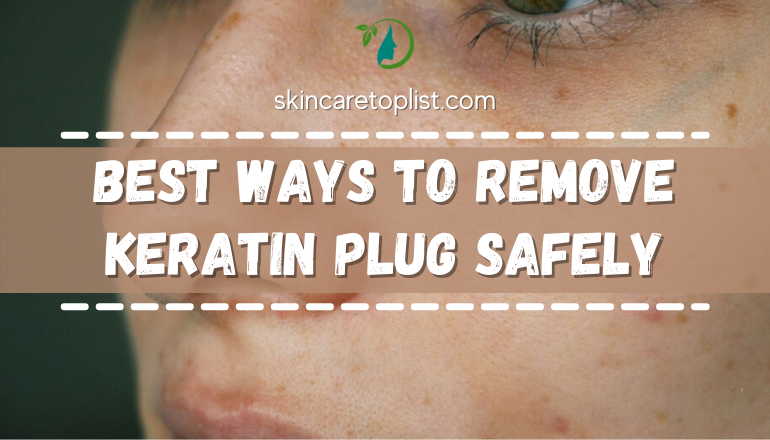 Best Ways To Remove Keratin Plug Safely